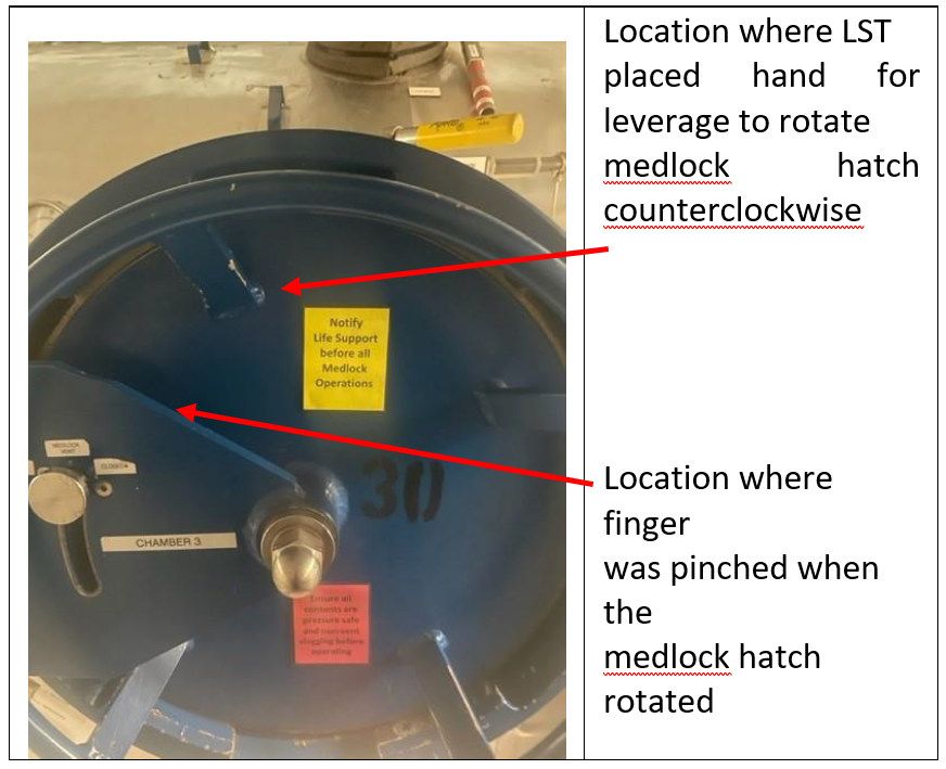 Lessons learned: Hand injury in medical airlock