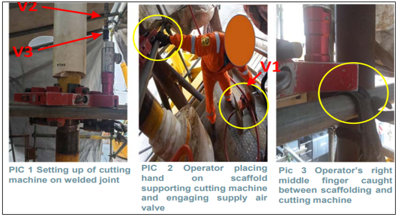 Lessons learned: Finger injury while setting up pipe cutting operation